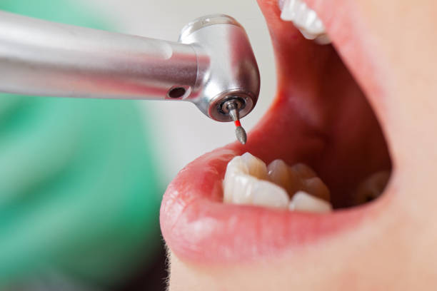 Best Emergency Treatment for Oral Infections in Tlassee, AL